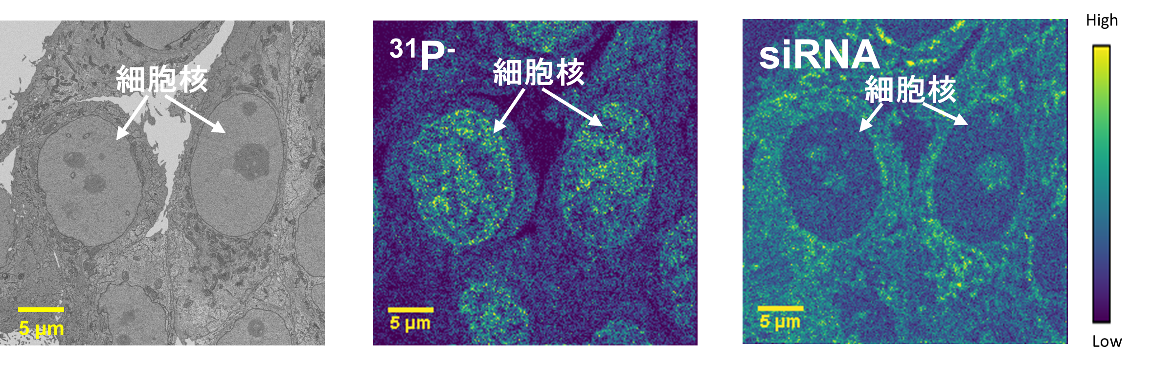 図１　培養細胞に導入したsiRNAの細胞内分布像
（左）SEM観察像、（中）31P-のNanoSIMS像、（右）siRNAのNanoSIMS像
